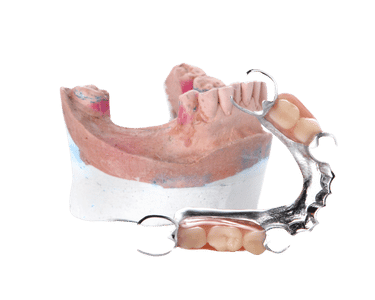Partial dentures